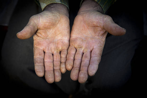 Two hands worn with work